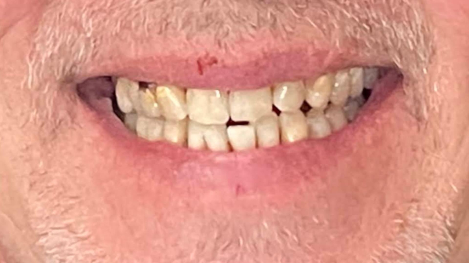 Patient before dental transformation
