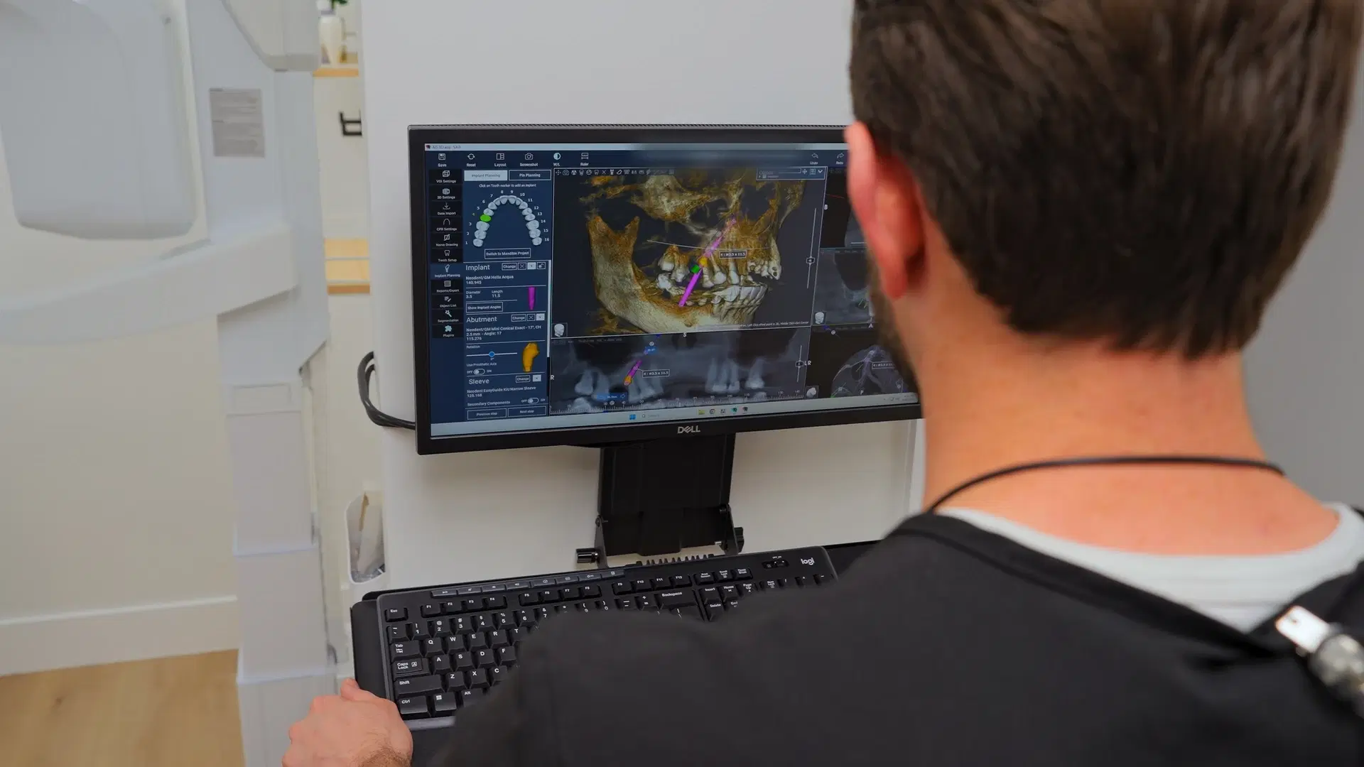 Dr. Gibby reviewing a 3D CBCT dental scan on a high-resolution monitor