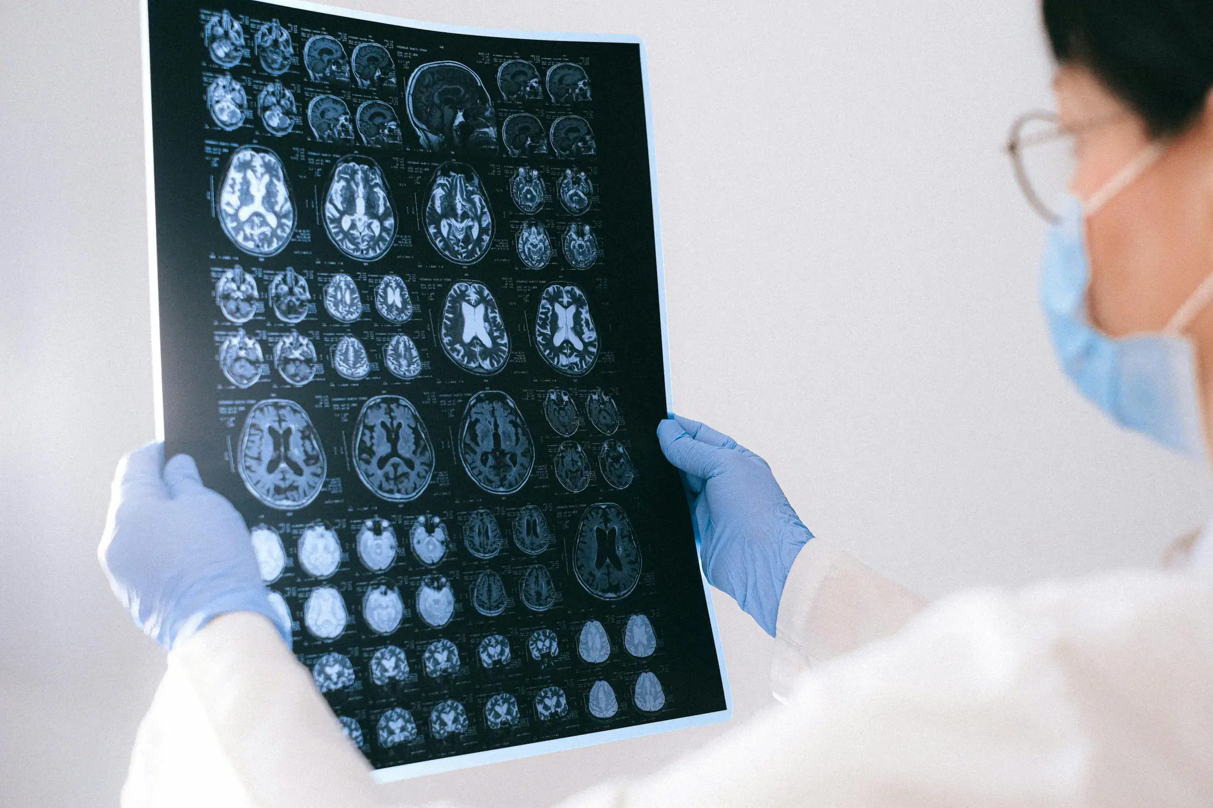 Gum Disease and Alzheimer's: The Surprising Connection Between Your Oral Health and Your Brain